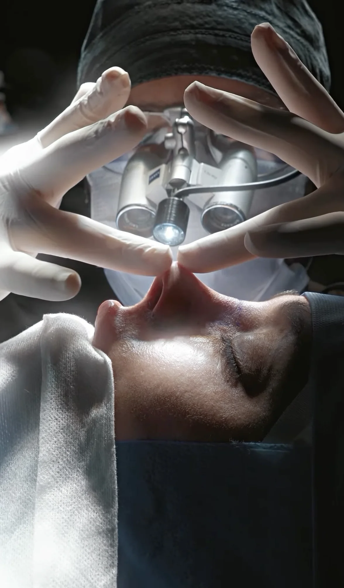 Resultados de rinoplastia